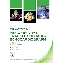 健康・医学 PERIOPERATIVE TRANSESOPHAGEAL Amazon | Perioperative Transesophageal Echocardiography Self